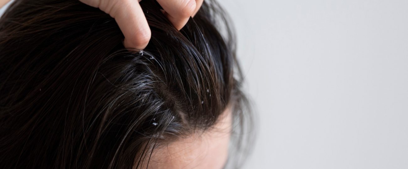 Dermatite, caspa e psoríase: como proteger a pele das armadilhas do inverno