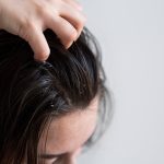 Dermatite, caspa e psoríase: como proteger a pele das armadilhas do inverno